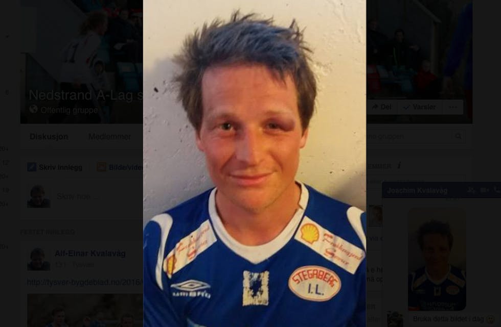 Vegard Stakland fekk seg ein skikkeleg blåveis i dag. Men han skåra to mål og var blid for det. Foto: Joachim Kvalavåg